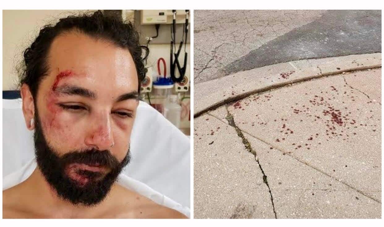 Image for A hit-and-run scooter crash nearly killed him. Now he's fighting for the data that could reveal the rider's identity. [telecom] 